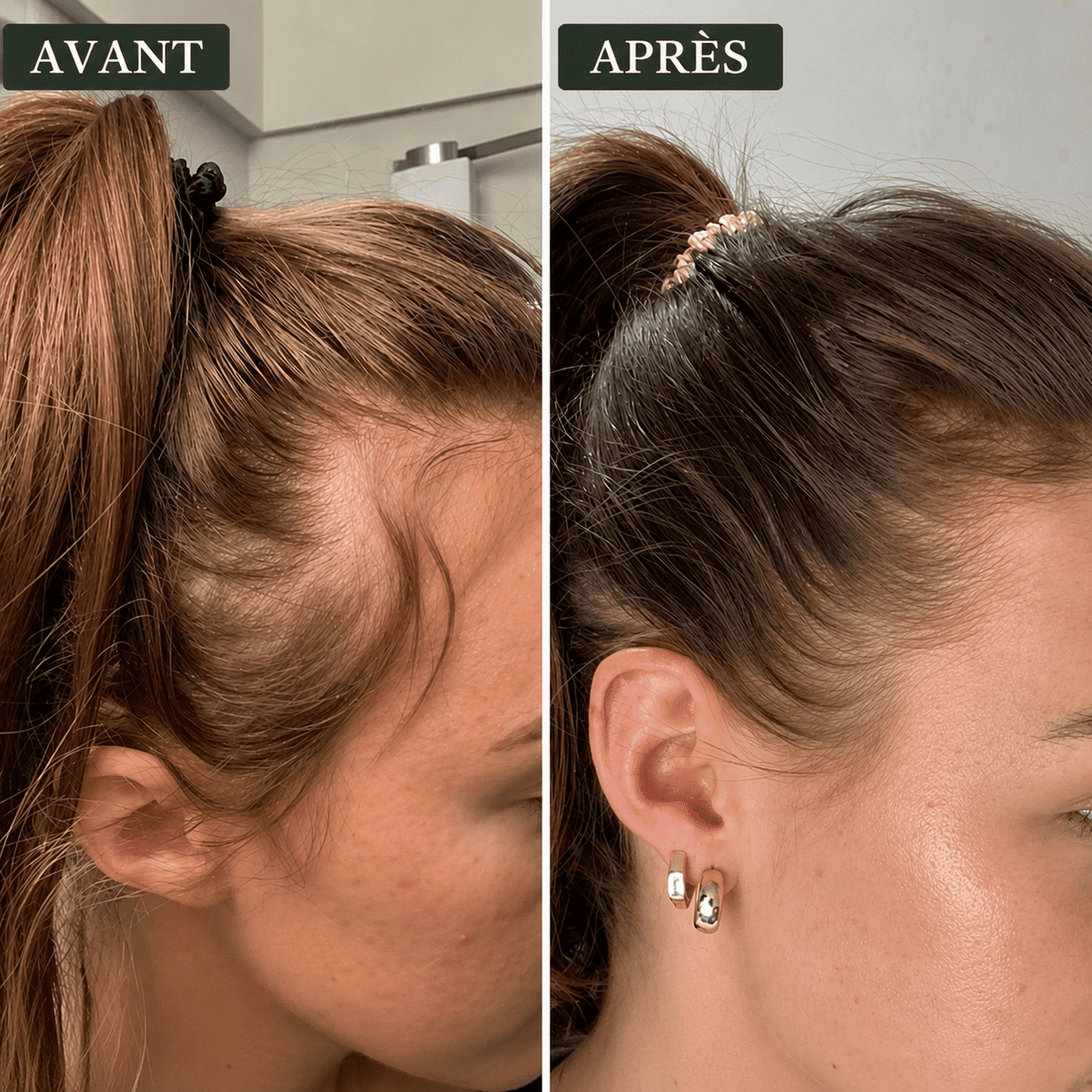 Savon Anti-Chute│Densité & Volume aux 7 Plantes