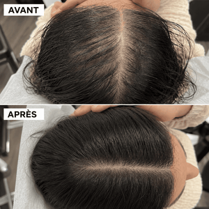 Savon Anti-Chute│Densité & Volume aux 7 Plantes