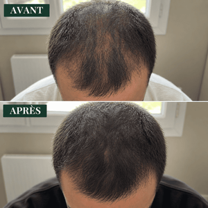 Savon Anti-Chute│Densité & Volume aux 7 Plantes